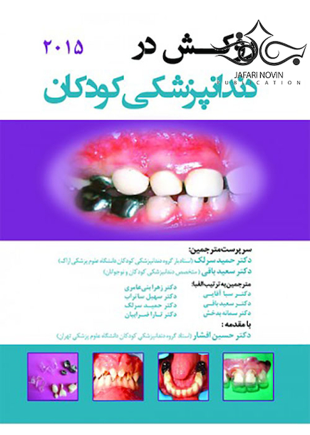 روکش در دندانپزشکی کودکان 2015