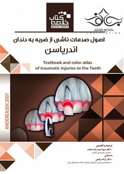 book brief خلاصه اصول صدمات ناشی از ضربه به دندان اندریاسن