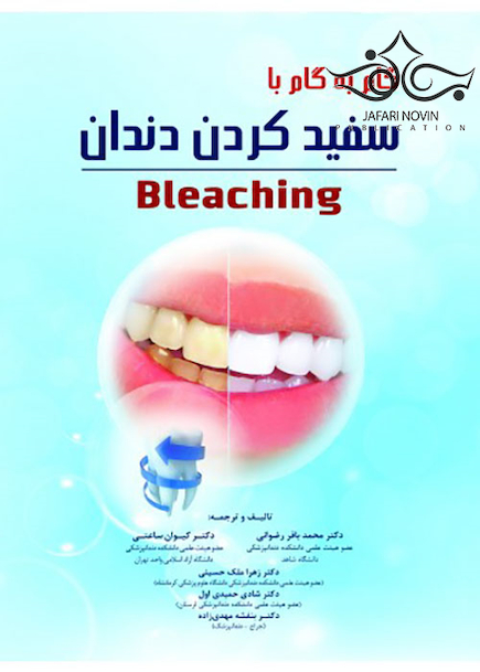 گام به گام با سفید کردن دندان Bleaching