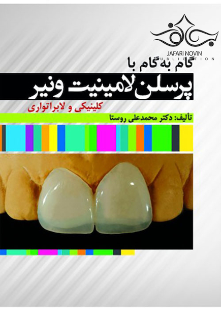 گام به گام با پرسلن لامینیت ونیر