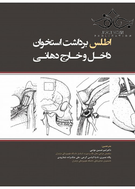 اطلس برداشت استخوان داخل و خارج دندان