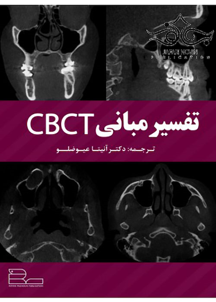 تفسیر مبانی CBCT