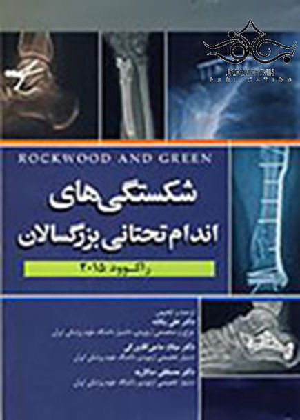 شکستگی های اندام تحتانی بزرگسالان راکوود 2015