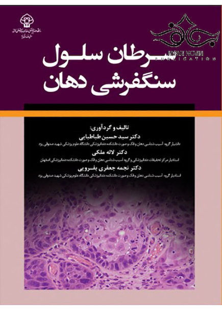 سرطان سلول سنگفرشی دهان