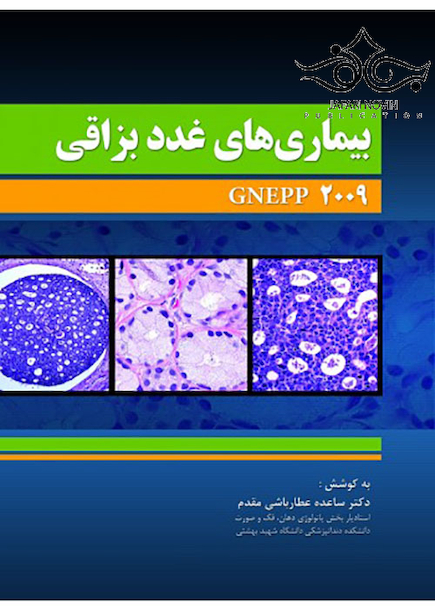 بیماری های غدد بزاقی Gnepp 2009