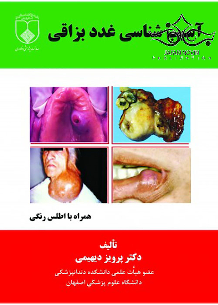 آسیب شناسی غدد بزاقی همراه با اطلس رنگی