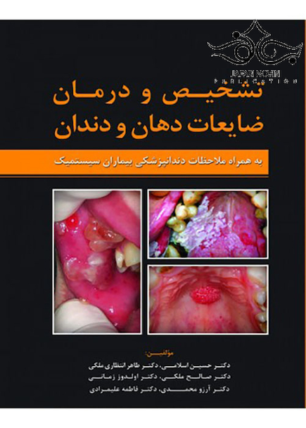 تشخیص و درمان ضایعات دهان و دندان