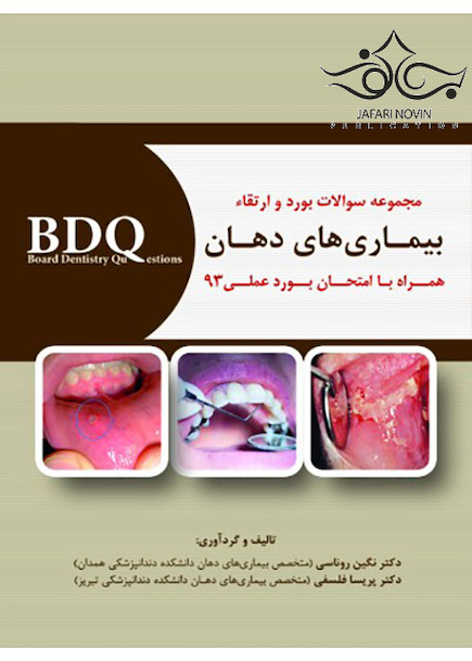 BDQ مجموعه سوالات بورد و ارتقاء بیماری های دهان همراه با امتحان بورد عملی 93