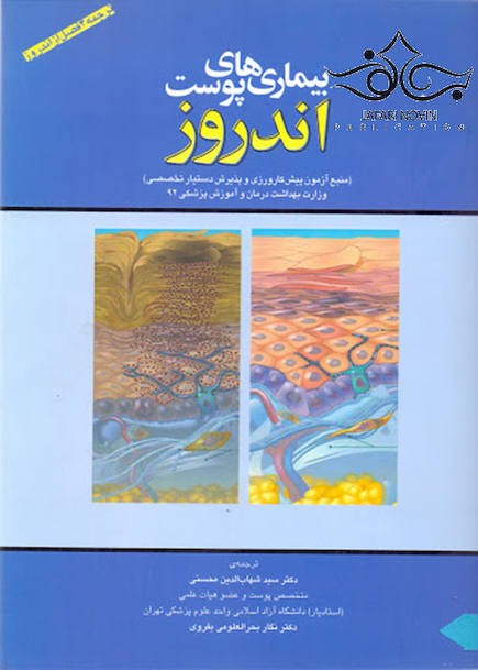 بیماریهای پوست اندروز