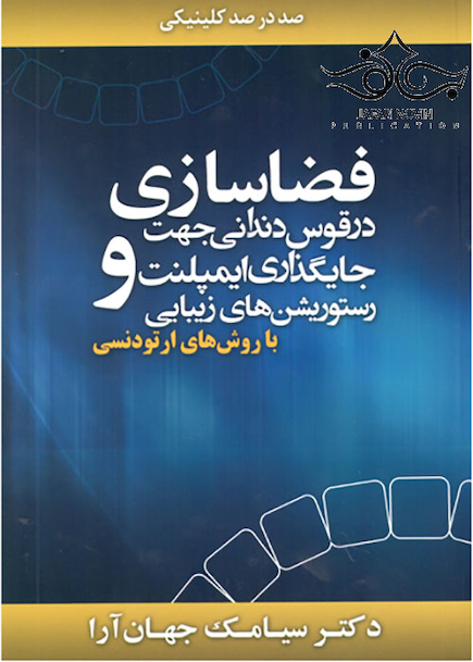 فضاسازی در قوس دندانی جهت جایگذاری ایمپلنت و رستوریشن های زیبایی با روش های ارتودنسی