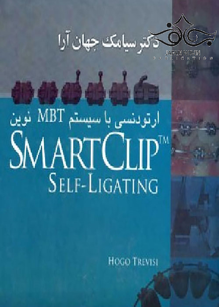 ارتودنسی با سیستم MBT نوین SMART CLIP TM SELF LIGATING