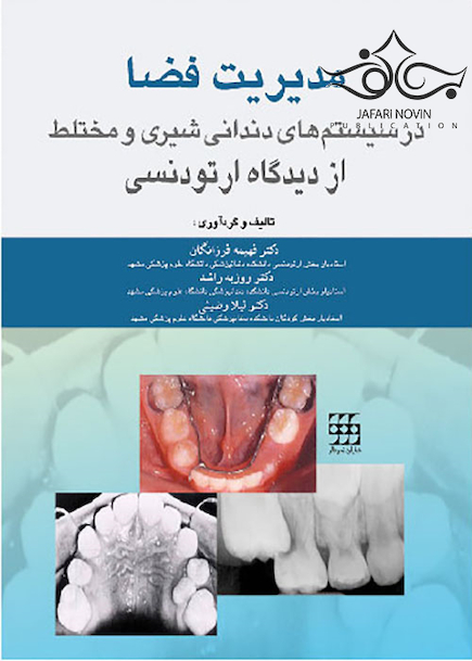 مدیریت فضا در سیستم های دندانی شیری و مختلط از دیدگاه ارتودنسی
