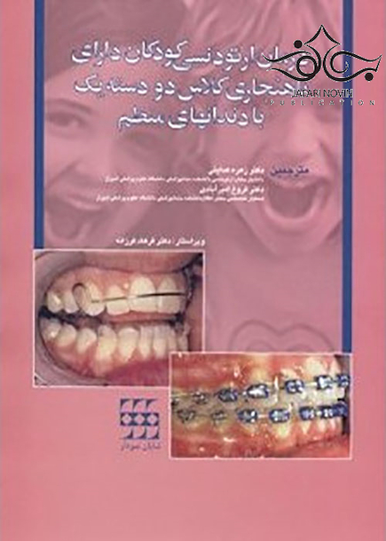 درمان ارتودنسی کودکان دارای ناهنجاری کلاس دو دسته یک با دندانهای منظم