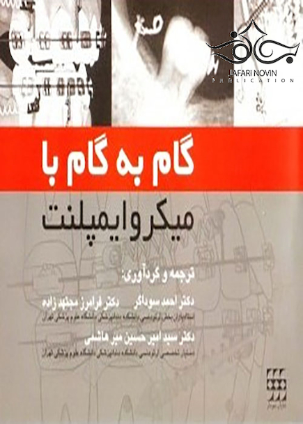 گام به گام با میکروایمپلنت