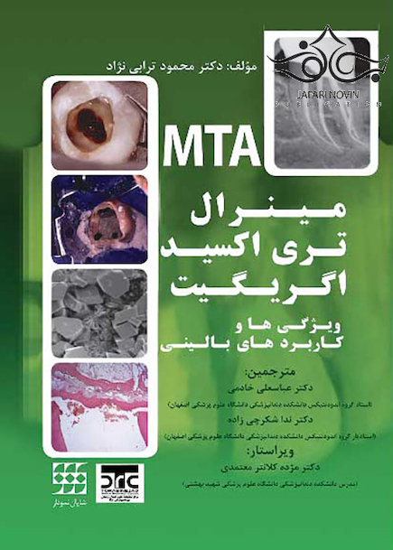 مینرال تری اکسید اگریگیت ویژگی ها و کاربردهای بالینی MTA