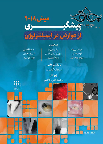 پیشگیری از عوارض در ایمپلنتولوژی میش 2018