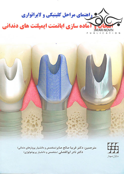 راهنمای مراحل کلینیکی و لابراتواری انتخاب و آماده سازی اباتمنت ایمپلنت های دندانی