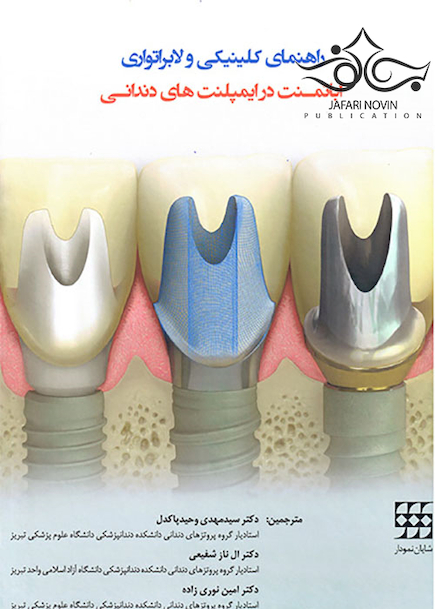 راهنمای کلینیکی و لابراتواری اباتمنت در ایمپلنت های دندانی