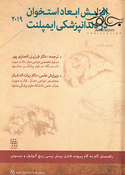 افزایش ابعاد استخوان در دندانپزشکی ایمپلنت 2019