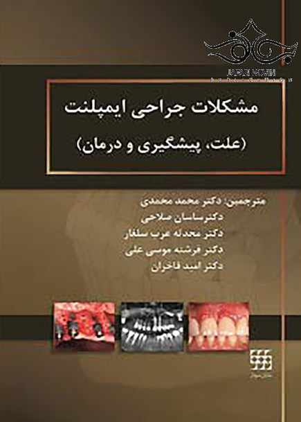 مشکلات جراحی ایمپلنت علت پیشگیری و درمان