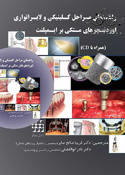 راهنمای مراحل کلینیکی و لابراتواری اوردنچرهای متکی بر ایمپلنت