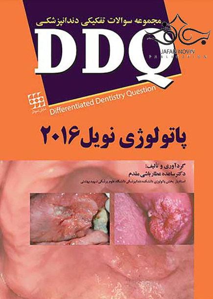 DDQ مجموعه سوالات تفکیکی دندانپزشکی پاتولوژی نویل 2016