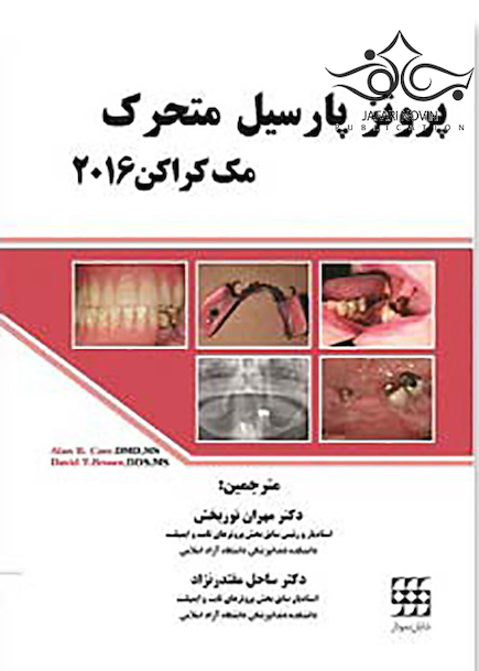 پروتز پارسیل متحرک مک کراکن 2016
