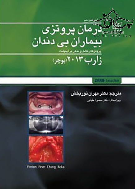 درمان پروتزی بیماران بی دندان زارب بوچر 2013