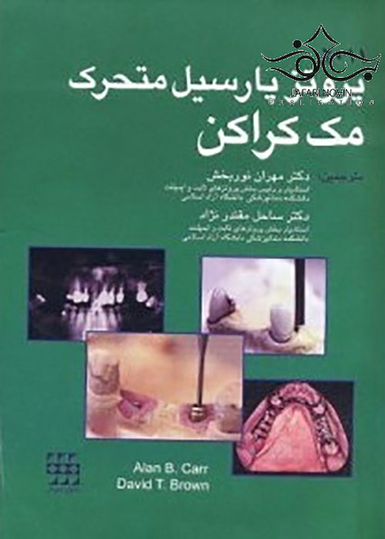 پروتز پارسیل متحرک مک کراکن 2011