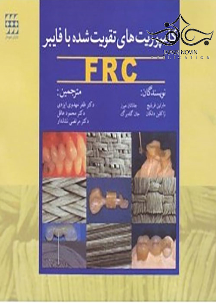 کامپوزیت های تقویت شده با فایبر FRC