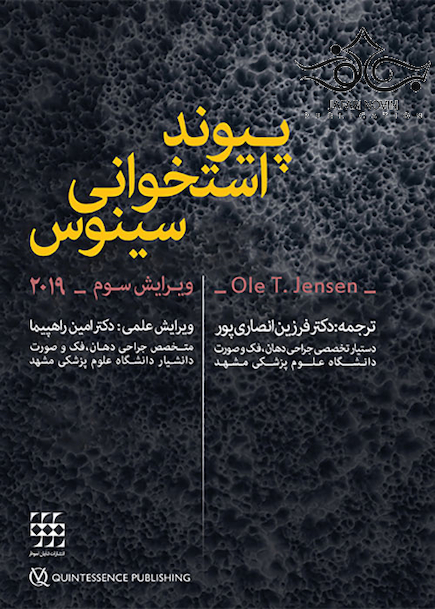 پیوند استخوانی سینوس 2019