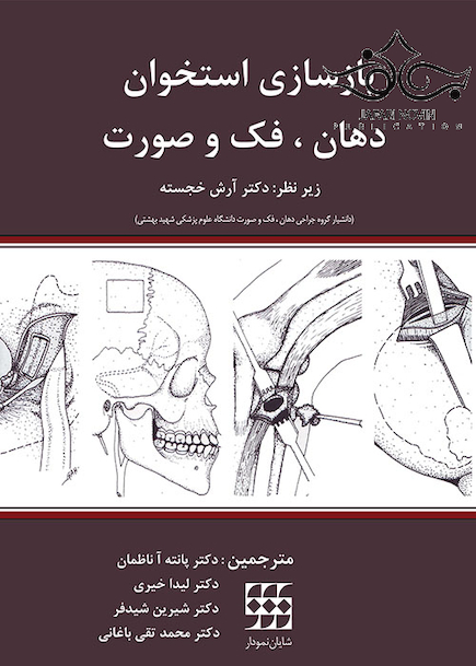 بازسازی استخوان دهان فک و صورت