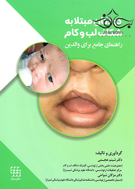کودکان مبتلا به شکاف لب و کام