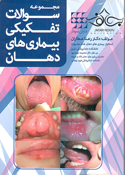 مجموعه سوالات تفکیکی بیماری های دهان