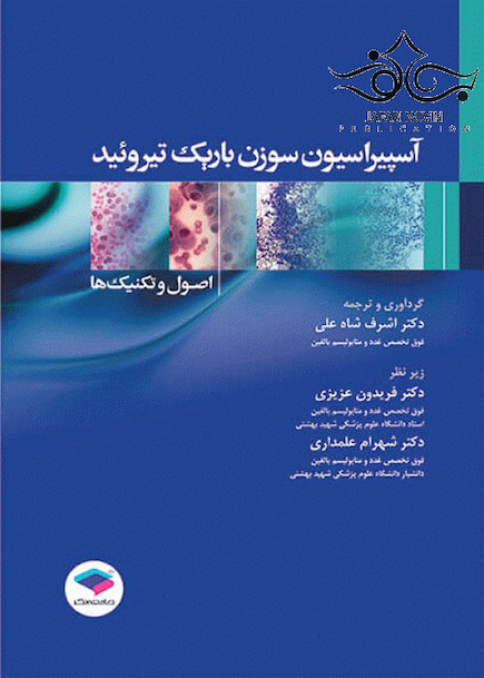 آسپیراسیون سوزن باریک تیروئید اصول و تکنیک ها