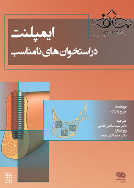 ایمپلنت در استخوان های نامناسب