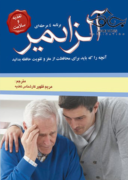 آلزایمر