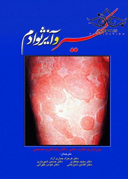 کهیر و آنژیوادم