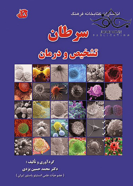 سرطان تشخیص و درمان