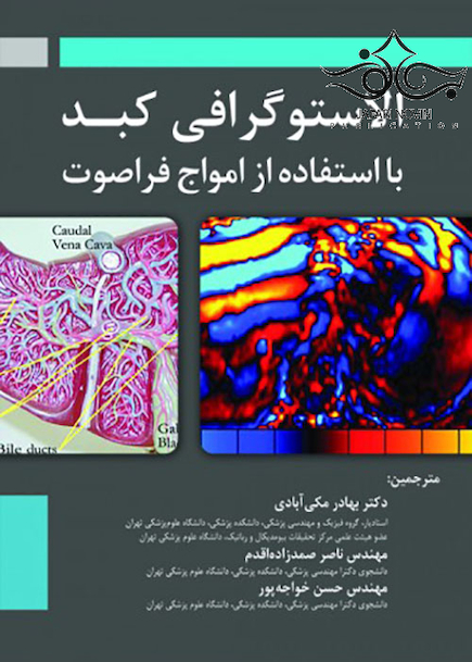 الاستوگرافی کبد با استفاده از امواج فراصوت