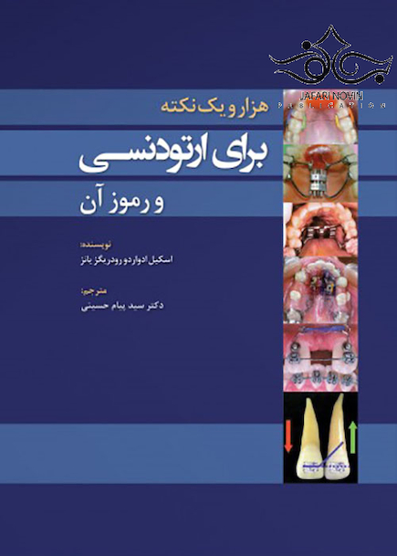 هزار و یک نکته برای ارتودنسی و رموز آن