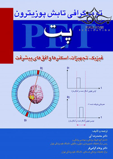 توموگرافی تابش پوزیترون پت