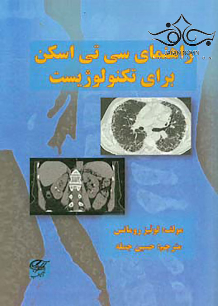 راهنمای سی تی اسکن برای تکنولوژیست
