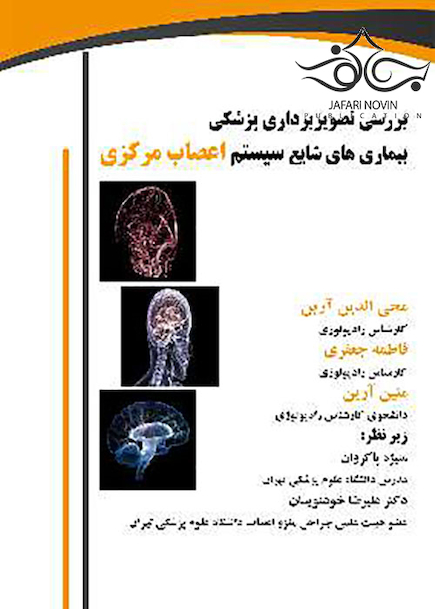 بررسی تصویربرداری پزشکی بیماری های شایع سیستم اعصاب مرکزی