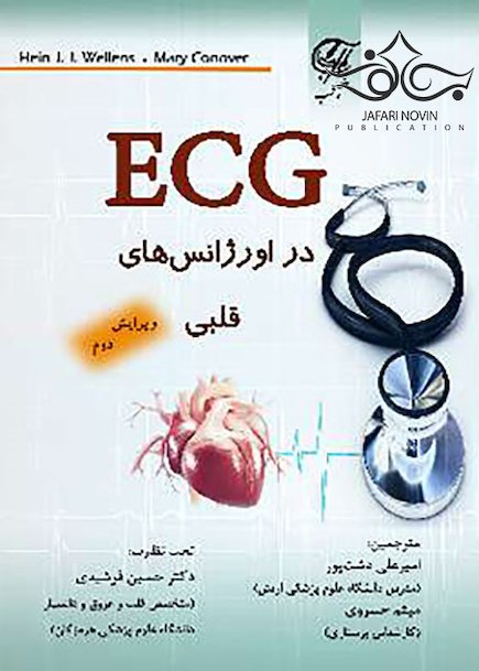 ECG در اورژانس های قلبی