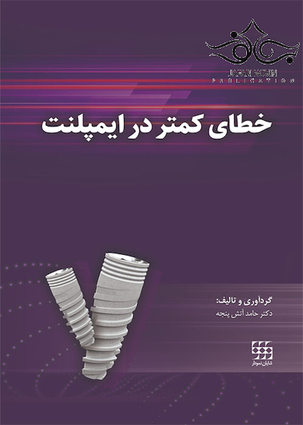 خطای کمتر در ایمپلنت