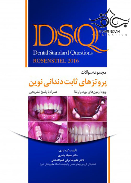 DSQ مجموعه سوالات پروتزهای ثابت دندانی نوین رزنستیل همراه با پاسخ تشریحی Rosenstiel 2016