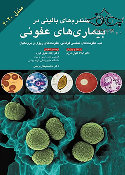 سندرم  های بالینی در بیماری  های عفونی مندل 2020
