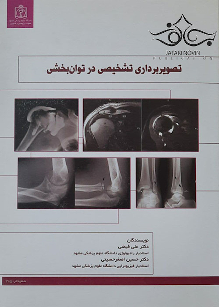 تصویربرداری تشخیصی در توان بخشی