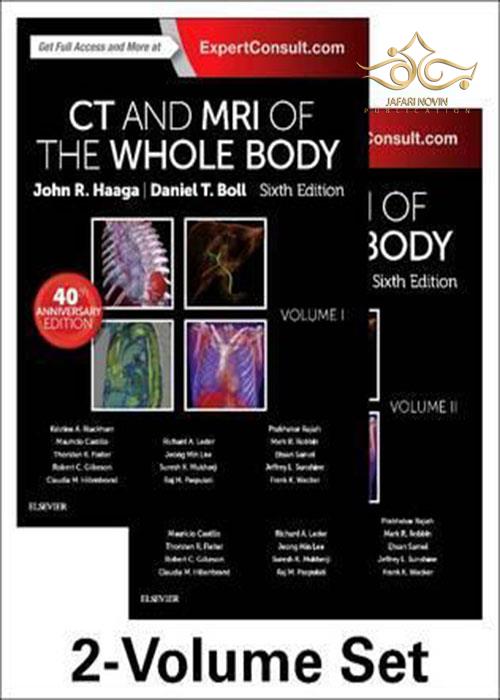 CT and MRI of the Whole Body, 2-Volume Set ELSEVIER